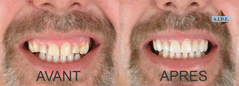 Rehabilitation cases before/after